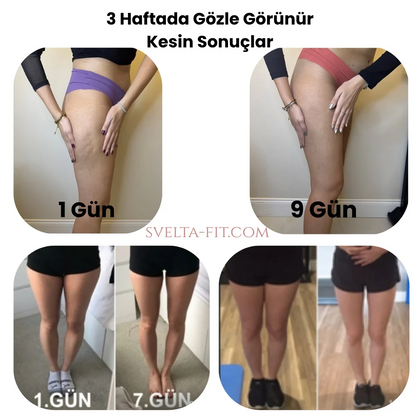 Svelta-Fıt Bacak İncelten Masaj Aleti
